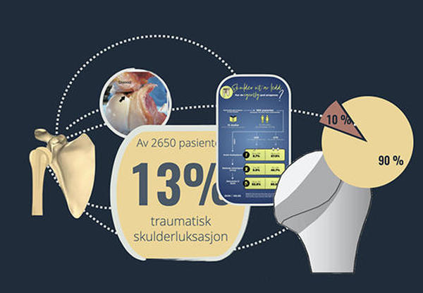 Traumatisk skulderluksasjon: operasjon eller ikke?