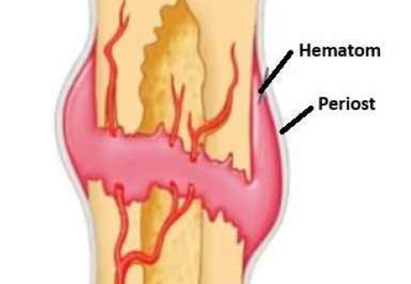 Del 1: Ultralyd ved akutte frakturer
