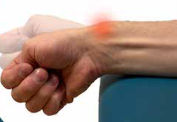 Tenosynovitt de Quervains